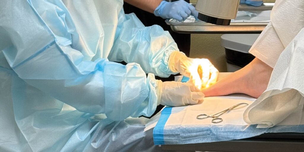 Tratamientos para hongos en Clínica Mi Pueblo en Oxnard, California